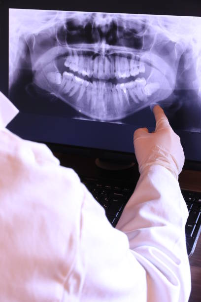 Best Emergency Tooth Extraction in Bainbridge, GA