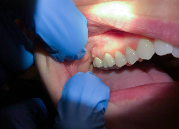 Best Pediatric Emergency Dentist in Bainbridge, GA
